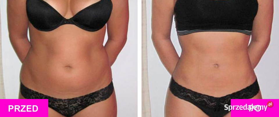 schudnąć Usuwamy tkankę tłuszczową Modelujemy Pielęgnacja, uroda, zdrowie Warszawa