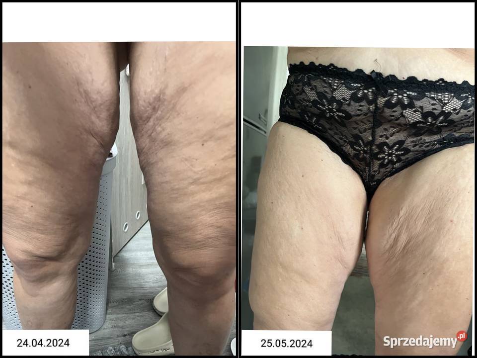 Termokrem ujędrniający Skuteczna pielęgnacja Hajnówka sprzedam