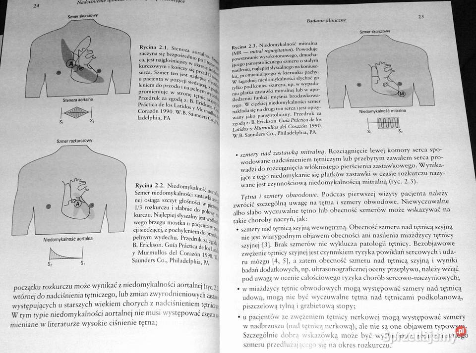 Nadciśnienie tętnicze i choroby współistniejące Pozostałe Chełm