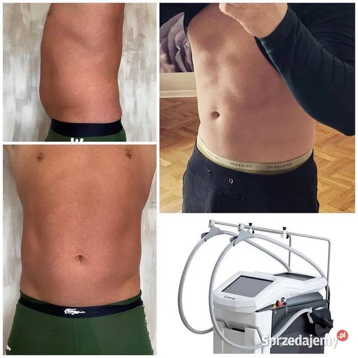 BodyLab Asclepion