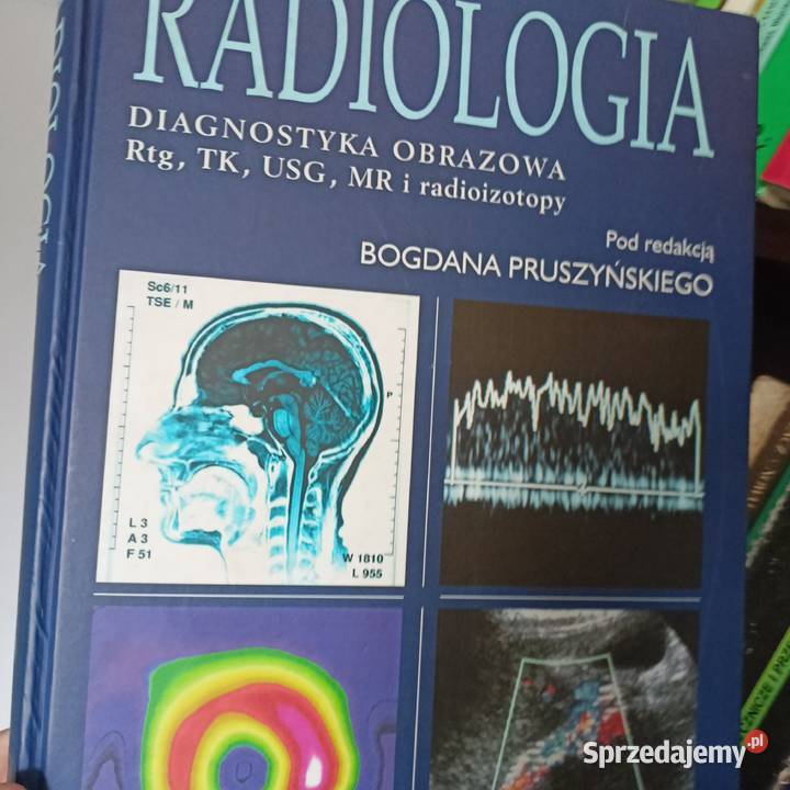 Radiologia diagnostyka książki wysyłka Gdańsk