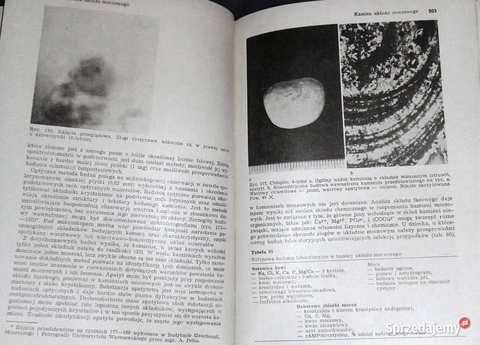 Genetycznie uwarunkowane zaburzenia metaboliczne