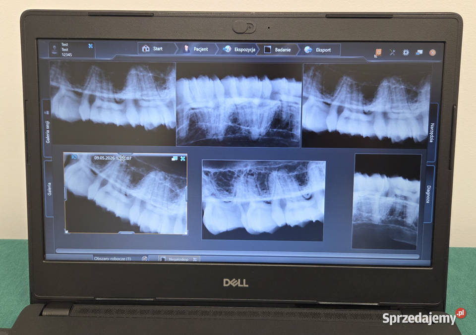 Radiowizjografia RVG Sirona Xios PLUS 1 Laptop Urządzenia Wrocław