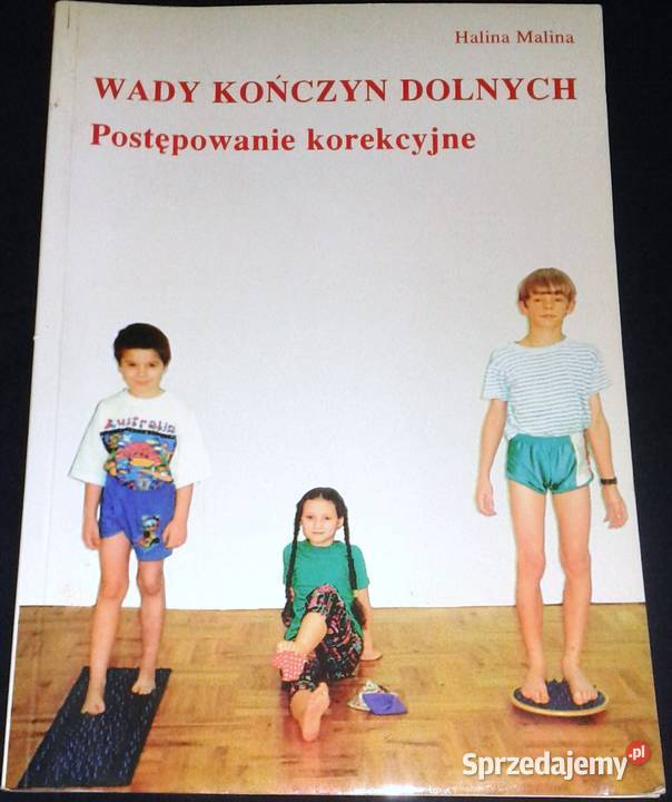 Wady kończyn dolnych Postępowanie korekcyjne Chełm