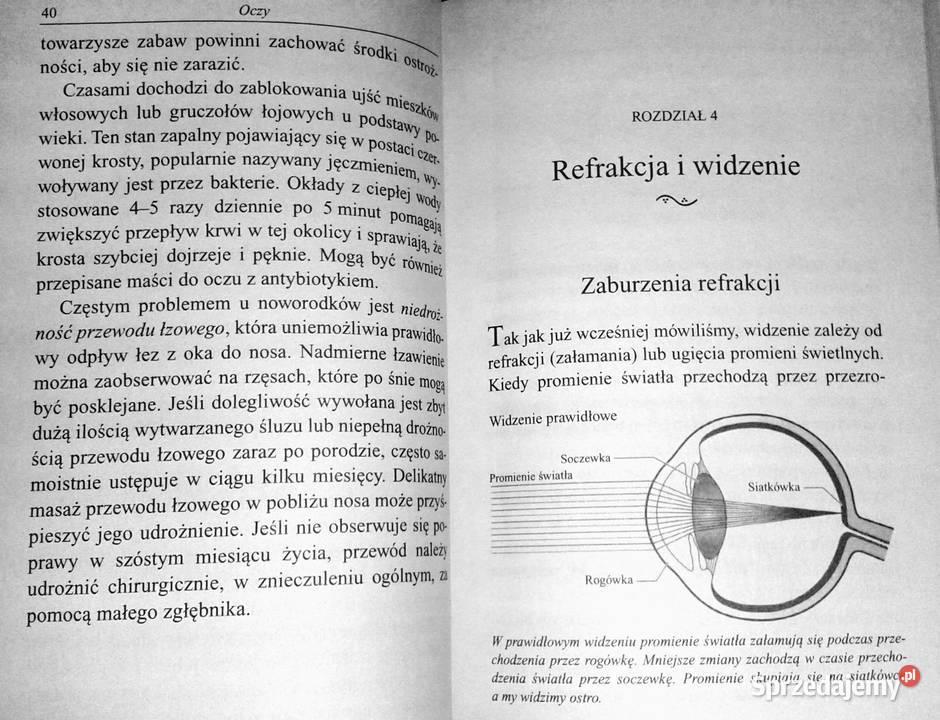 Oczy Współczesne metody korekcji zaburzeń Chełm