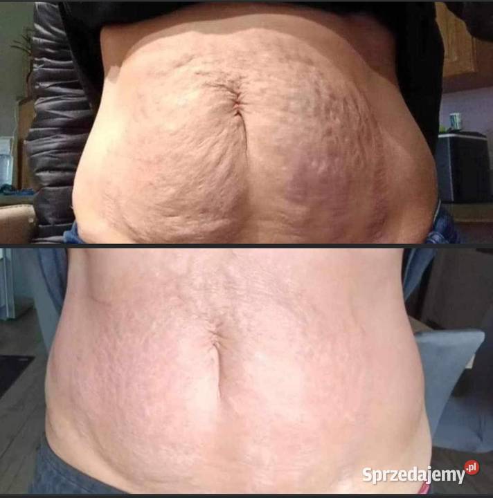 Termokrem ujędrniający Skuteczna pielęgnacja Hajnówka