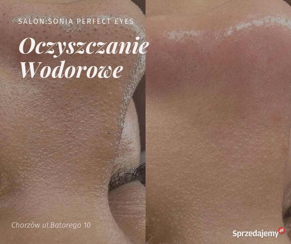 Oczyszczanie Wodorowe Chorzów sprzedam
