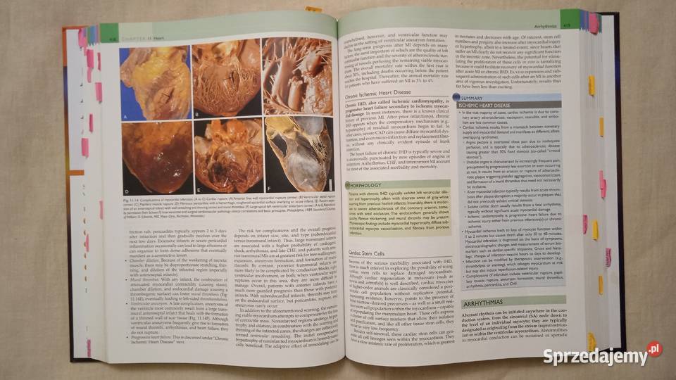 Robbins Basic Pathology Warszawa