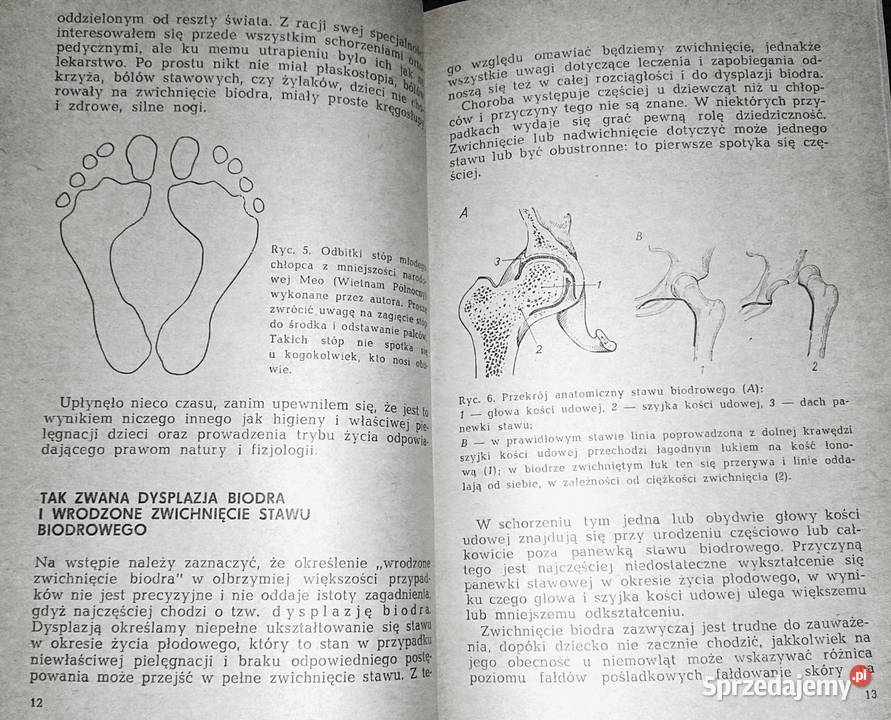 Chcę mieć zdrowe nogi Artur Dziak Chełm