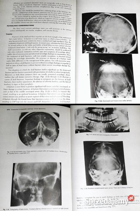Introduction to Clinical Radiology Richard miękka Chełm