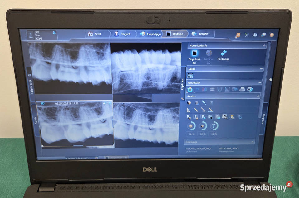Radiowizjografia RVG Sirona Xios PLUS 1 Laptop Wrocław