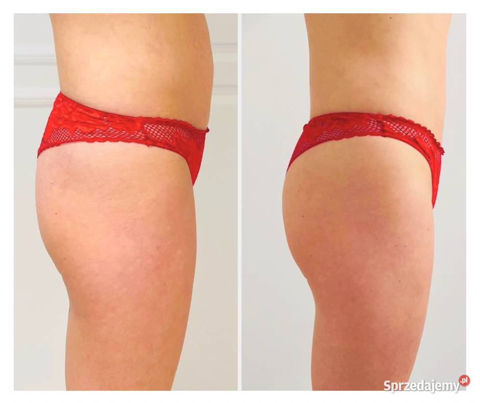 Icoone laser wynajem mazowieckie Warszawa