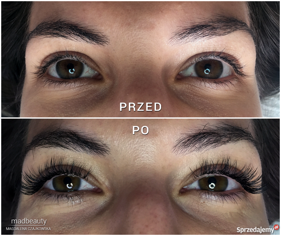 Przedłużanie rzęs Warszawa zdrowie