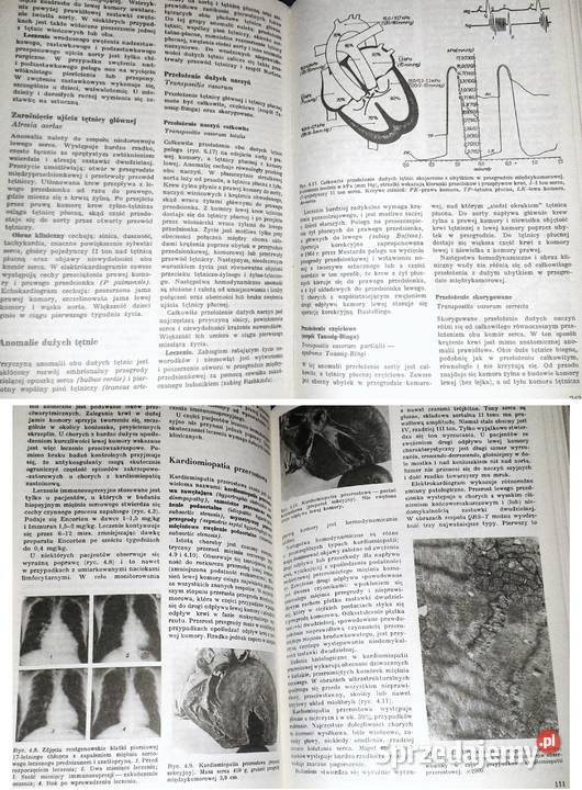 Nauka o chorobach wewnętrznych Tom 2 Witold