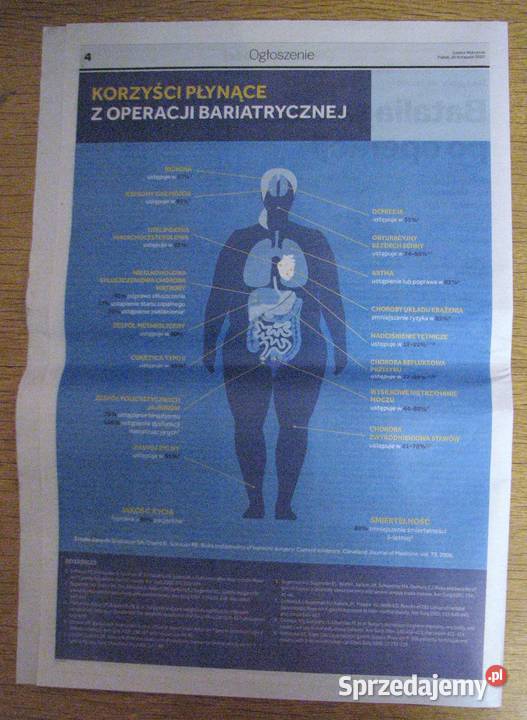 Otyłość Leczenie Gazeta Wyborcza lubelskie sprzedam