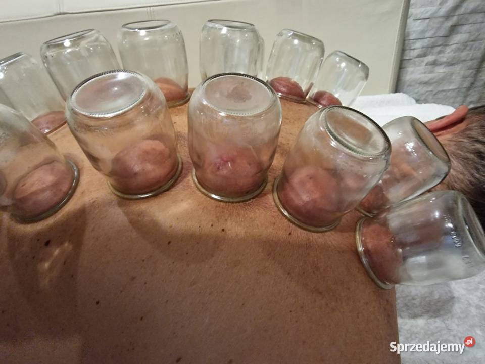 Bańki Ogniowe Chorzów