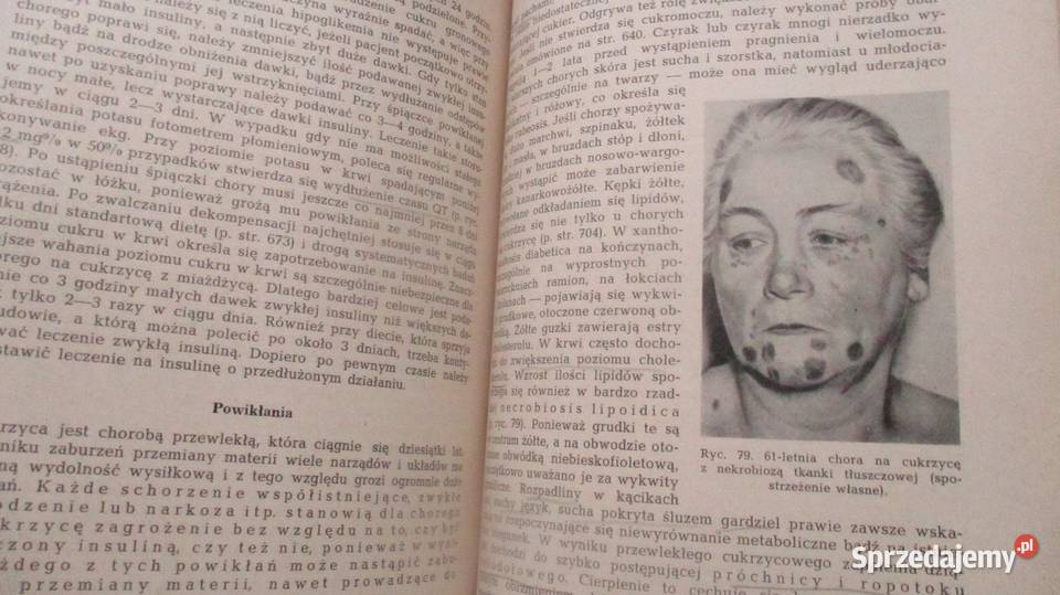 Fizjoterapia Weiss Zembaty kinezyterapia Książki naukowe i popularnonaukowe Łódź sprzedam