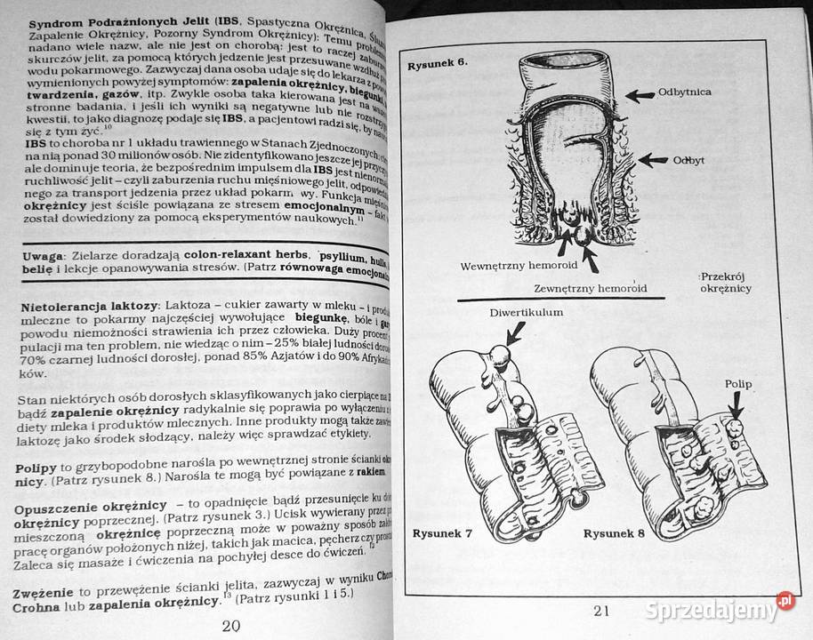 Czyszczenie okrężnicy Jennifer Weiss Rok wydania 1993 Chełm sprzedam