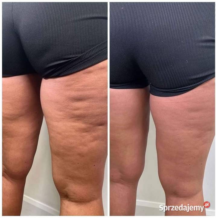 Termokrem ujędrniający Skuteczna pielęgnacja