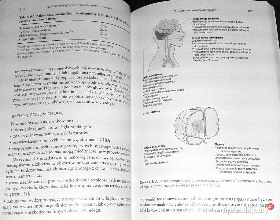 Nadciśnienie tętnicze i choroby współistniejące lubelskie Chełm