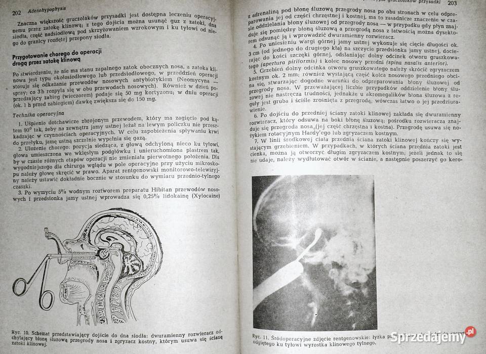 Endokrynologia kliniczna Tom 1 Walenty Hartwig Chełm sprzedam