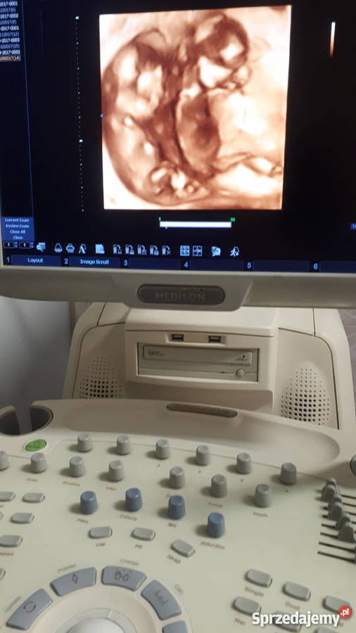 APARAT USG MEDISON X8 4 sondy Gdańsk sprzedam