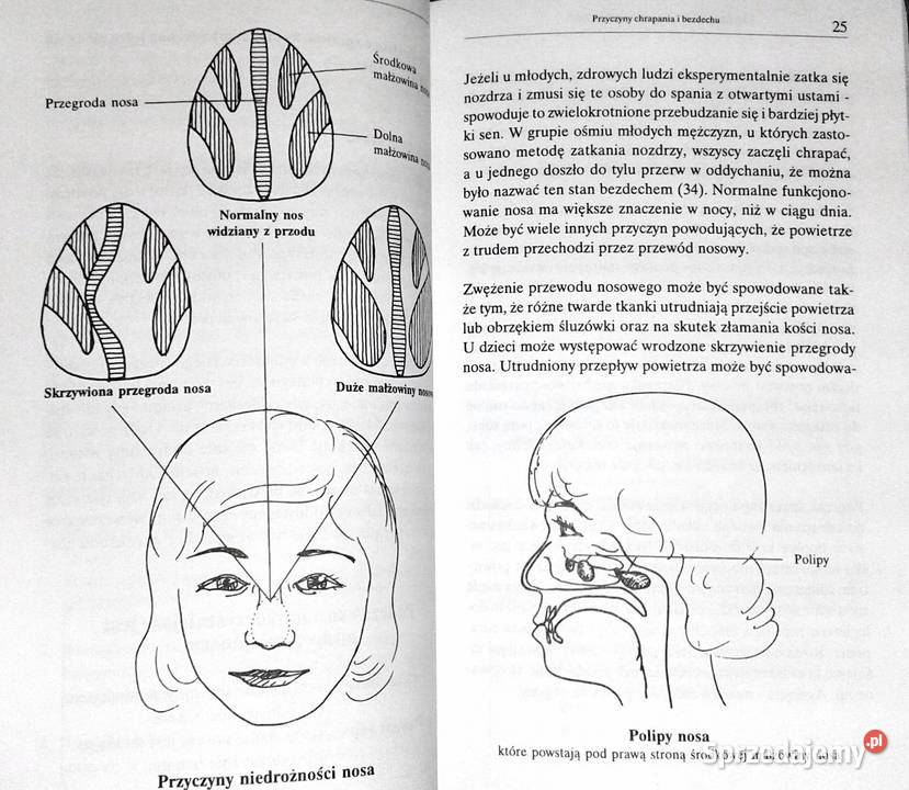 Przestań chrapać zacznij żyć Tore Strandell miękka Chełm