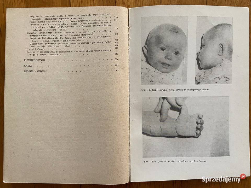 Choroby układu nerwowego dzieci i młodzieży Mysłowice