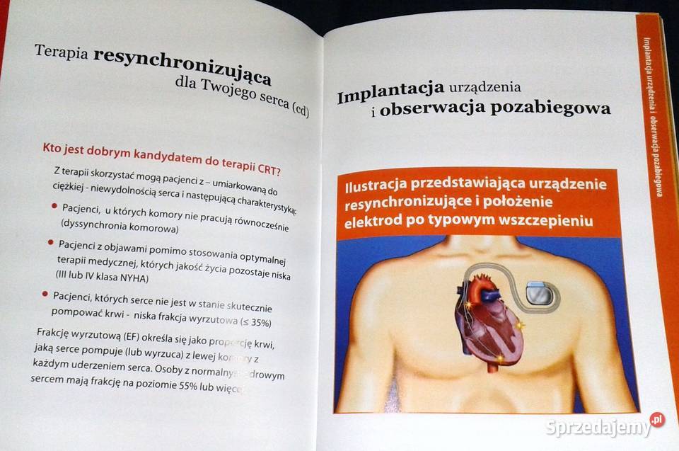 Zrozumienie terapii resynchronizacji serca w Chełm