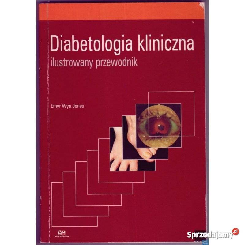 Diabetologia kliniczna Emyr Wyn Jones medycyna, nauki medyczne Świdnica
