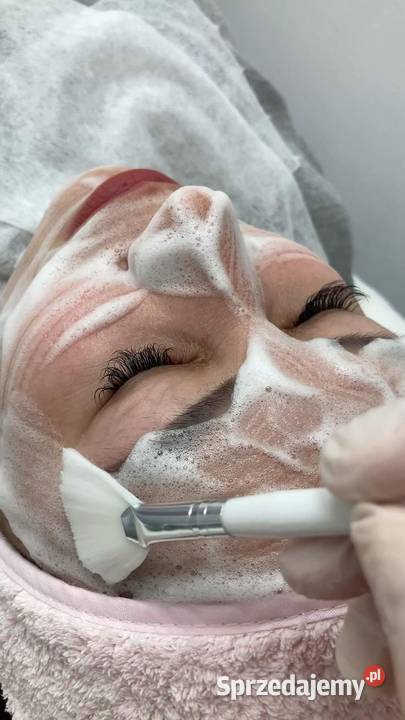 Oczyszczenie wodorowe szybki sposób na piękną Chorzów