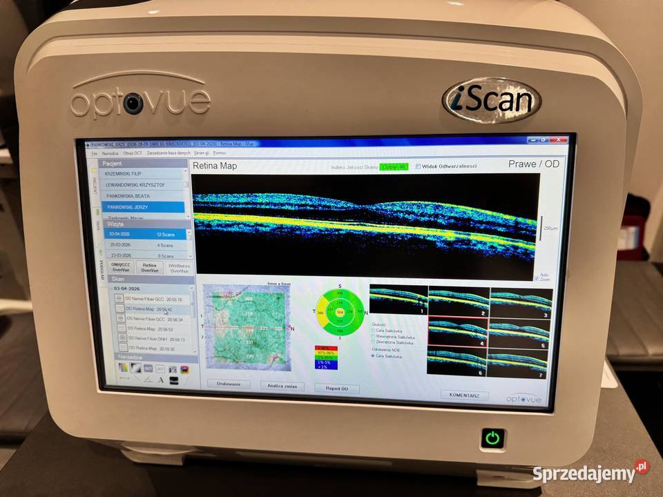 OCT tomograf okulistyczny OPTOVUE ISCAN Poznań sprzedam