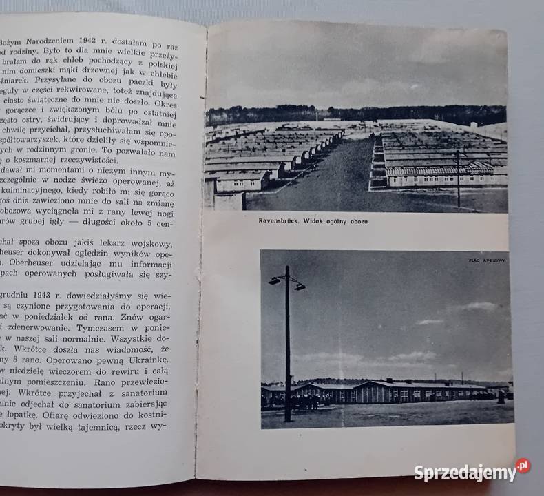 Ponad ludzką miarę Wspomnienia operowanych z Rav Koźminek