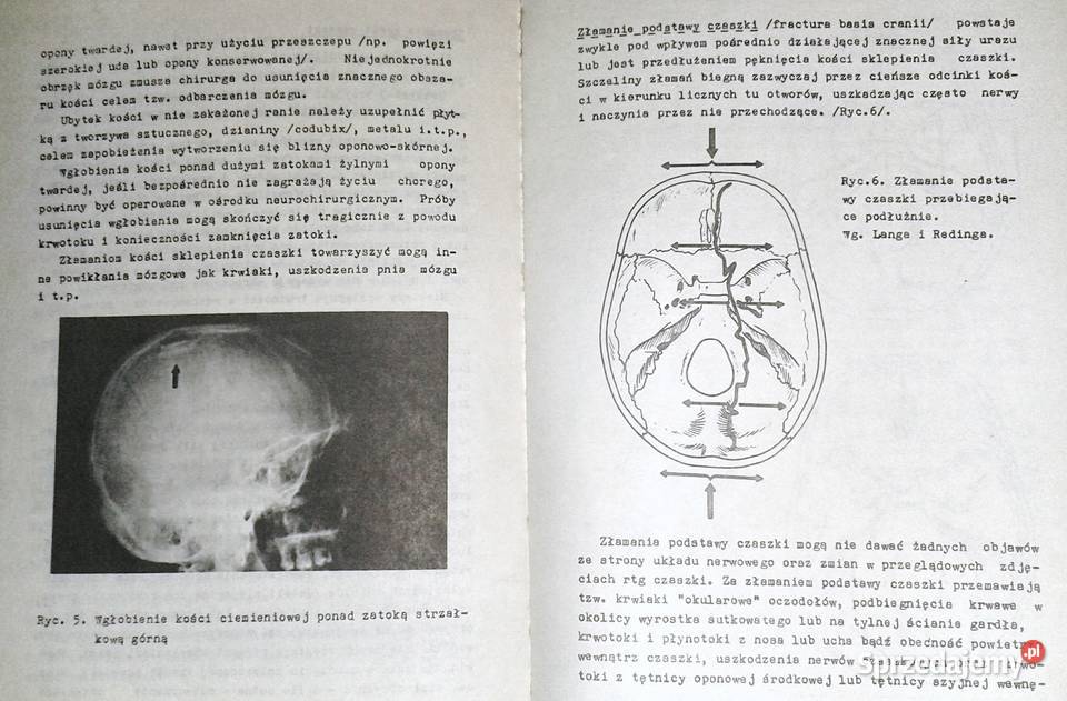Urazy i obrażenia wielonarządowe Cz 1 A Kawalski lubelskie Chełm