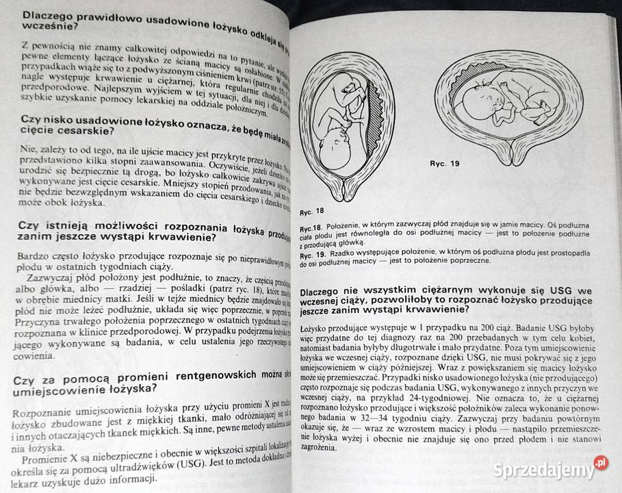Wszystko o ciąży Geoffrey Chamberlain miękka lubelskie Chełm sprzedam