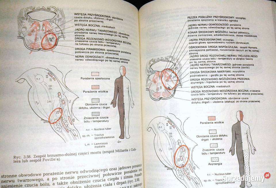 Diagnostyka topograficzna w neurologii Peter lubelskie Chełm