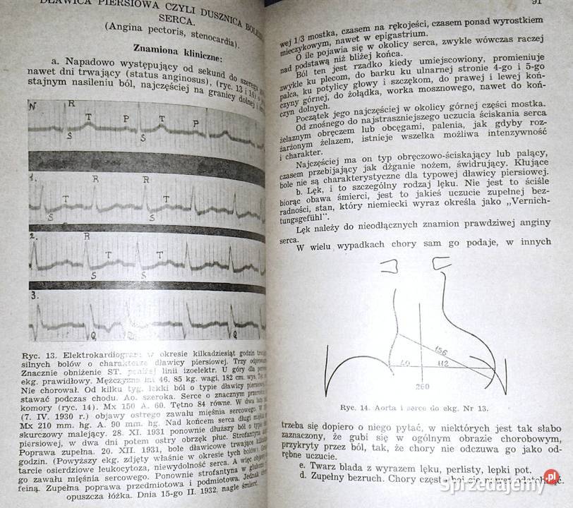 Diagnostyka i terapia chorób serca Witold Chełm sprzedam