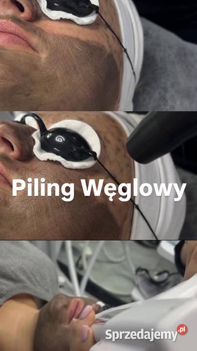 Piling węglowy Ruda Śląska