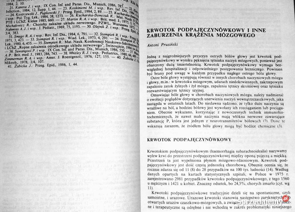 Ostre bóle głowy Antoni Prusiński Chełm
