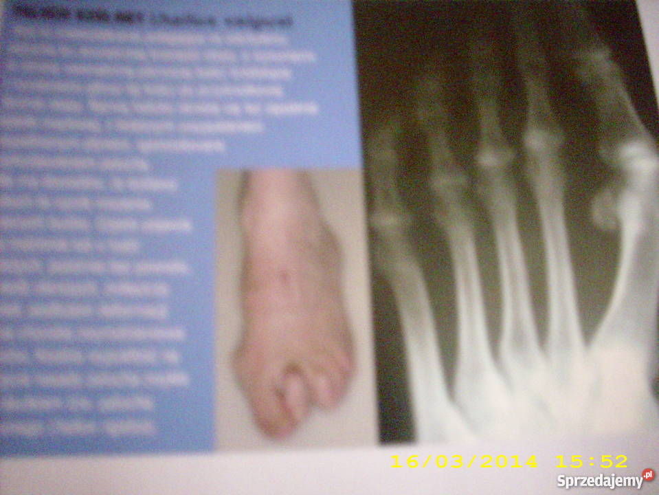 Zdrowe kości mięśnie stawy Goleniów