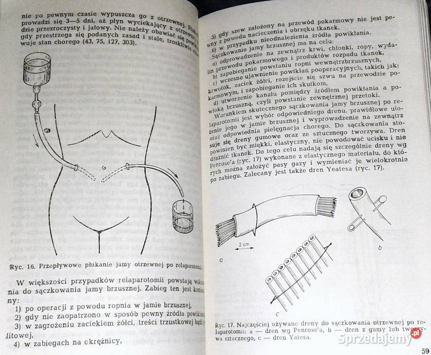 Wczesne powtórne otwarcie jamy brzusznej Leszek miękka Książki i Podręczniki Chełm