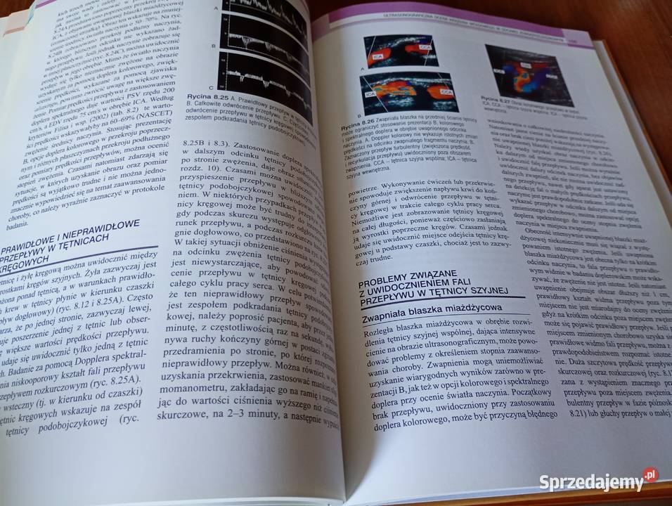 Ultrasonografia naczyń obwodowych Abigail Thrush pomorskie Gdańsk