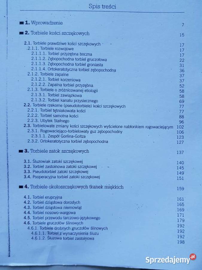 Torbiele obszaru szczękowotwarzowego Tomasz Kielce