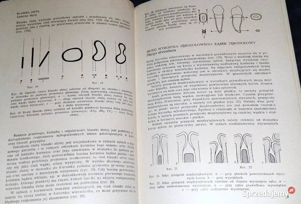 Zarys rentgenodiagnostyki stomatologicznej Z Chełm sprzedam