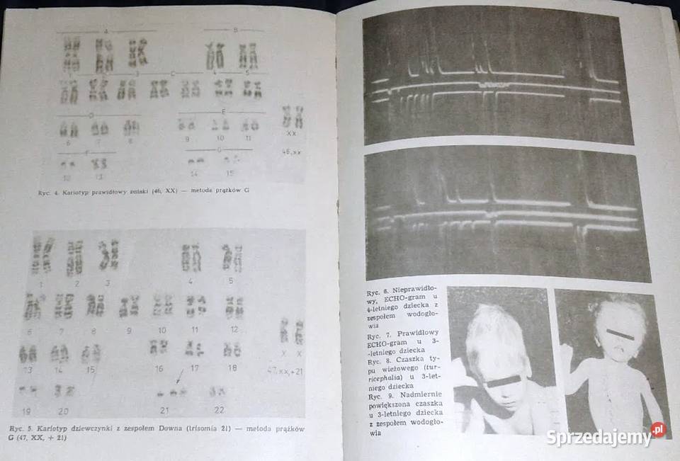 Choroby układu nerwowego dzieci i młodziezy J Chełm