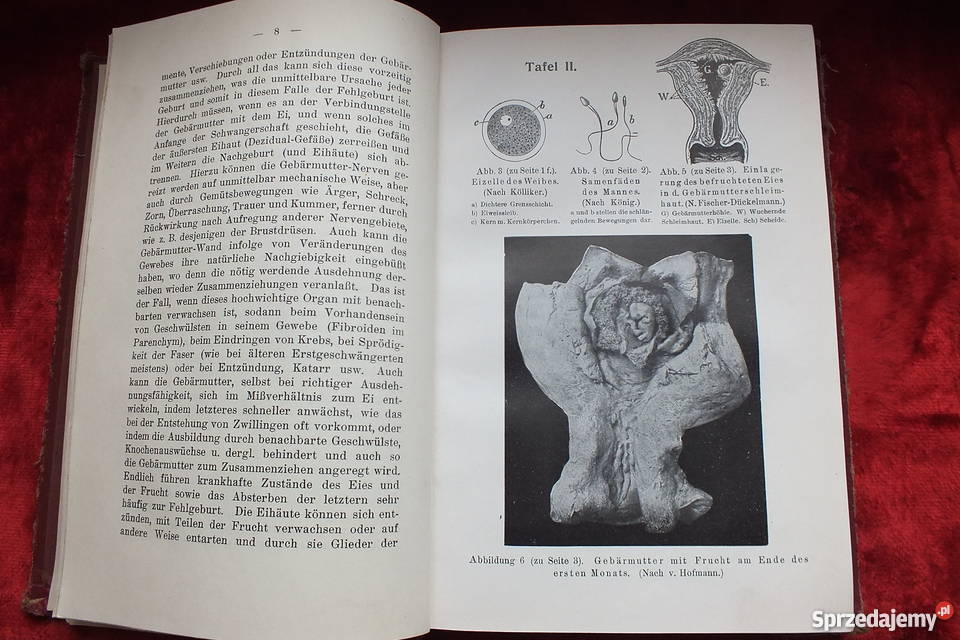 Stara książka Ginekologi Ein dunkler punkt 1907 Żary sprzedam