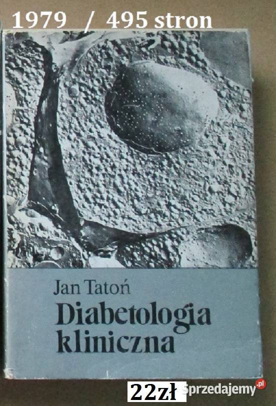 Choroby naczyń HRykowski naczynia interna medycyna, nauki medyczne Łódź