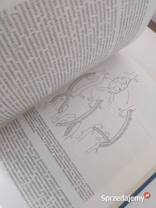 książka medyczna Choroby naczyń Henryk Rykowski Kielce