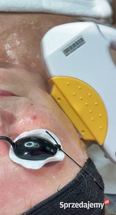 Fotoodmladzanie ipl Zdrowie i Uroda