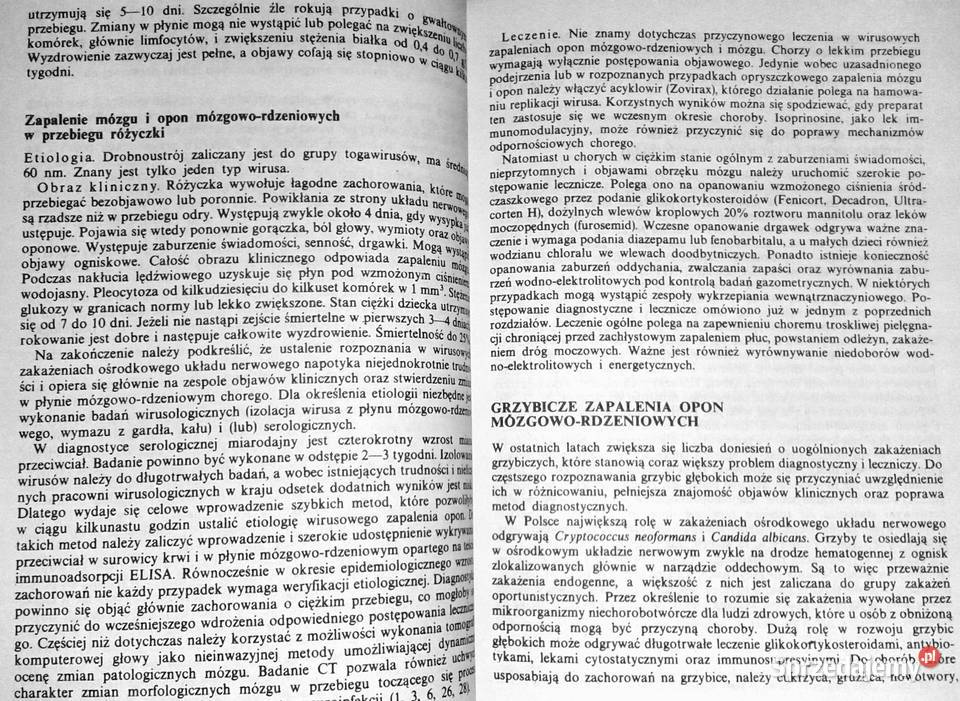 Ostre bóle głowy Antoni Prusiński Chełm